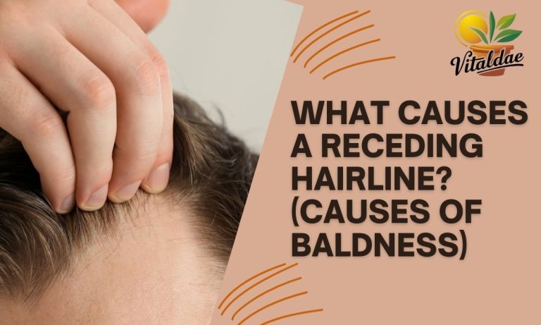 What Causes a Receding Hairline? (Causes of Baldness)